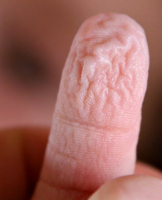 2008-10-13-pruny-finger.jpg