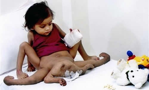 lakshmi-8-legs.jpg